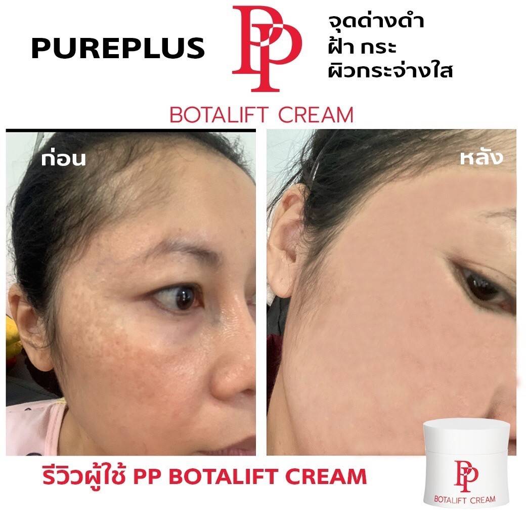 PP รีวิว จุดด่างดำ