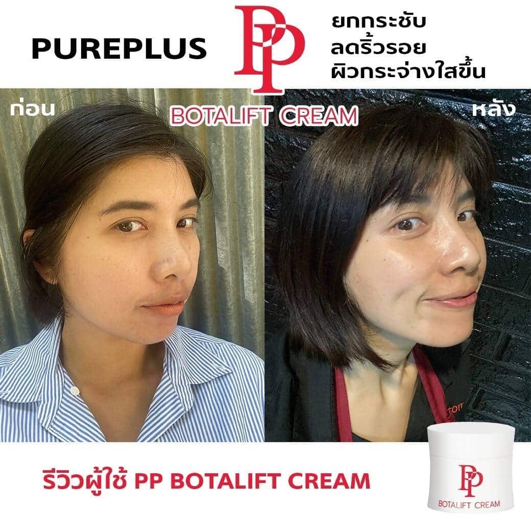 PP รีวิว ยกกระชับ